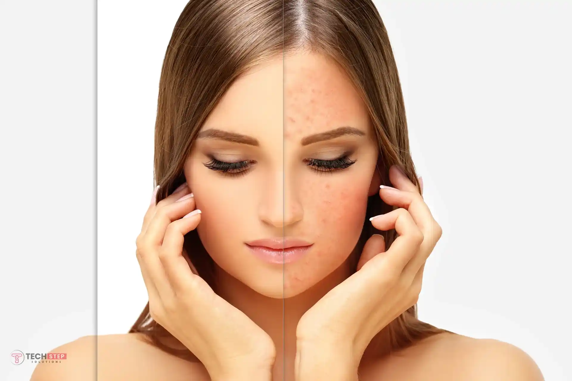 how to get rid of redness on face