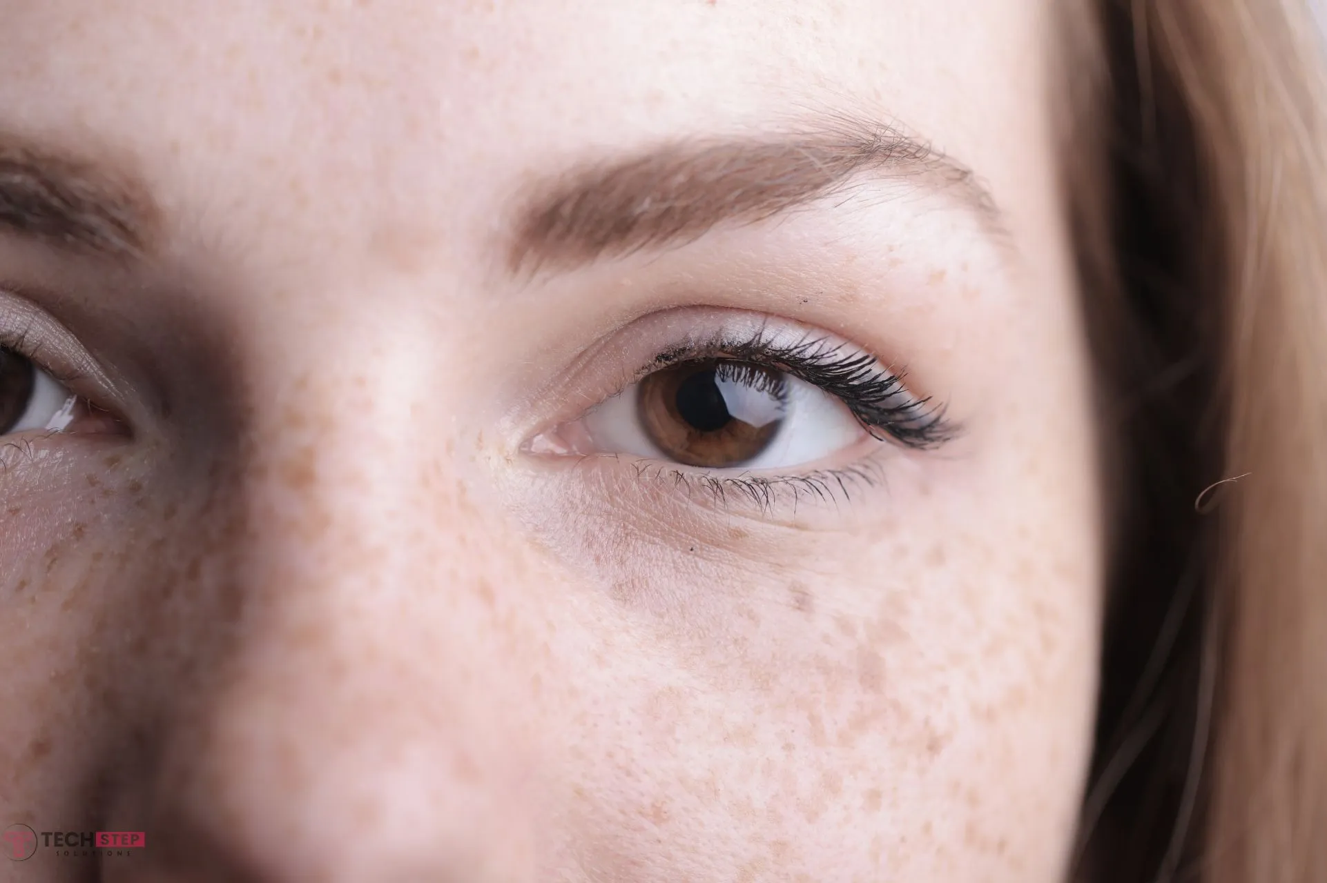hyperpigmentation treatment near me before and after results