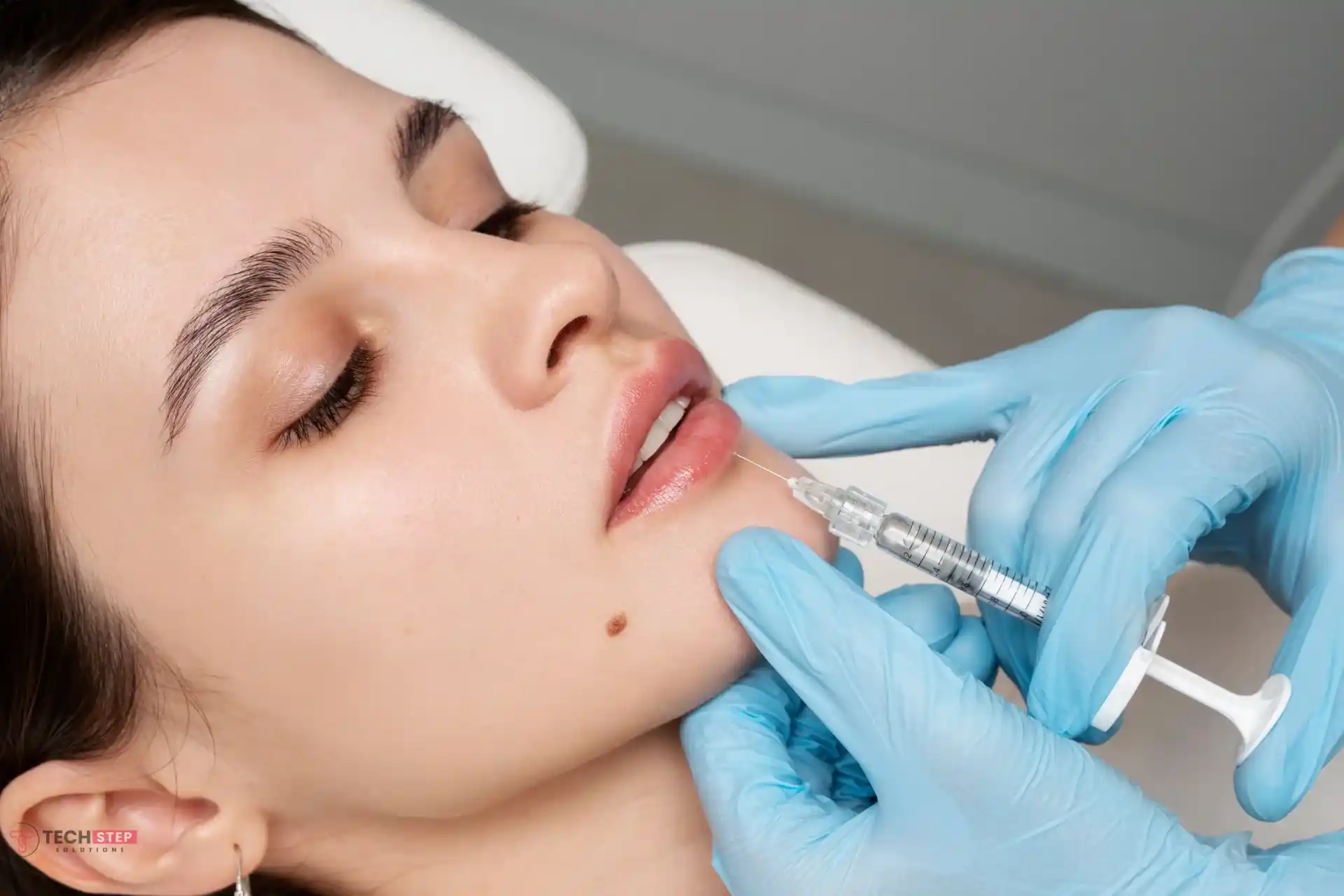 is dermal filler lip filler