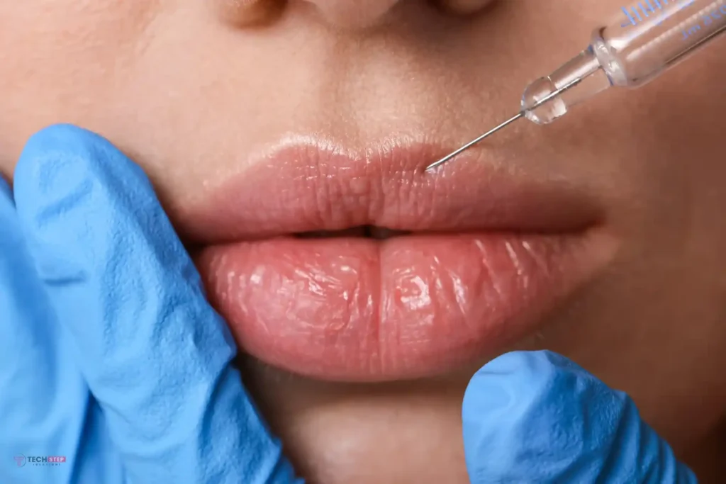 what is lip filler