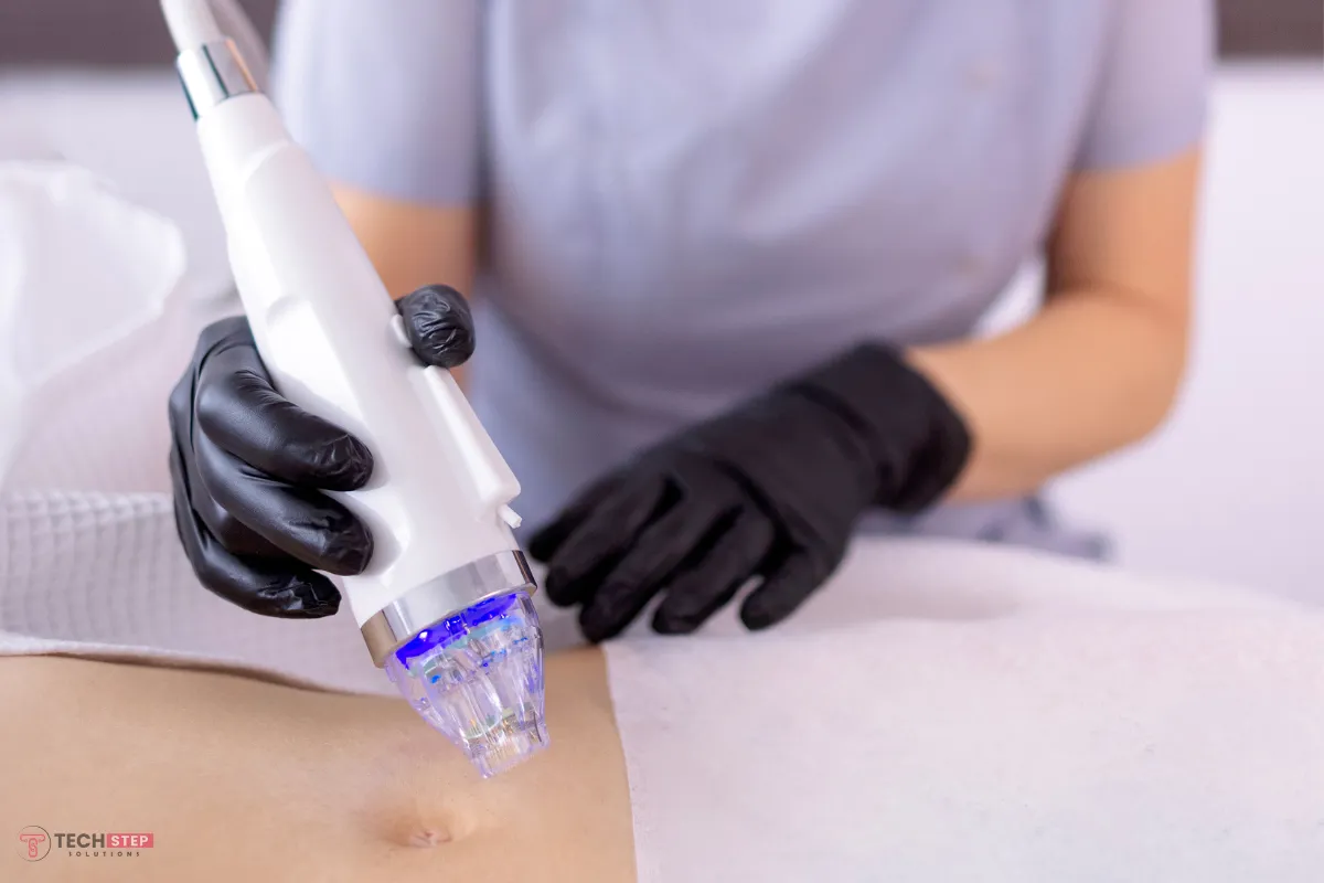 RadioFrequency Microneedling Lake Forest,CA