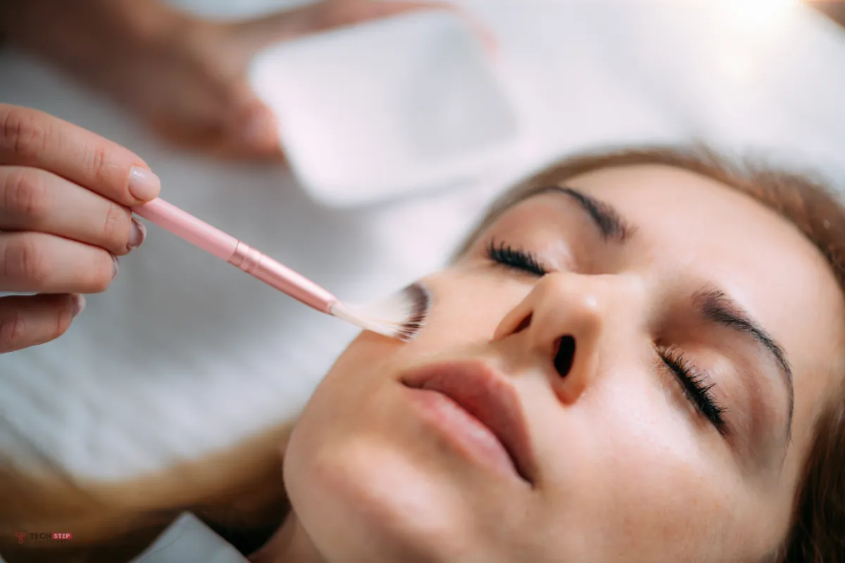 chemical peels
